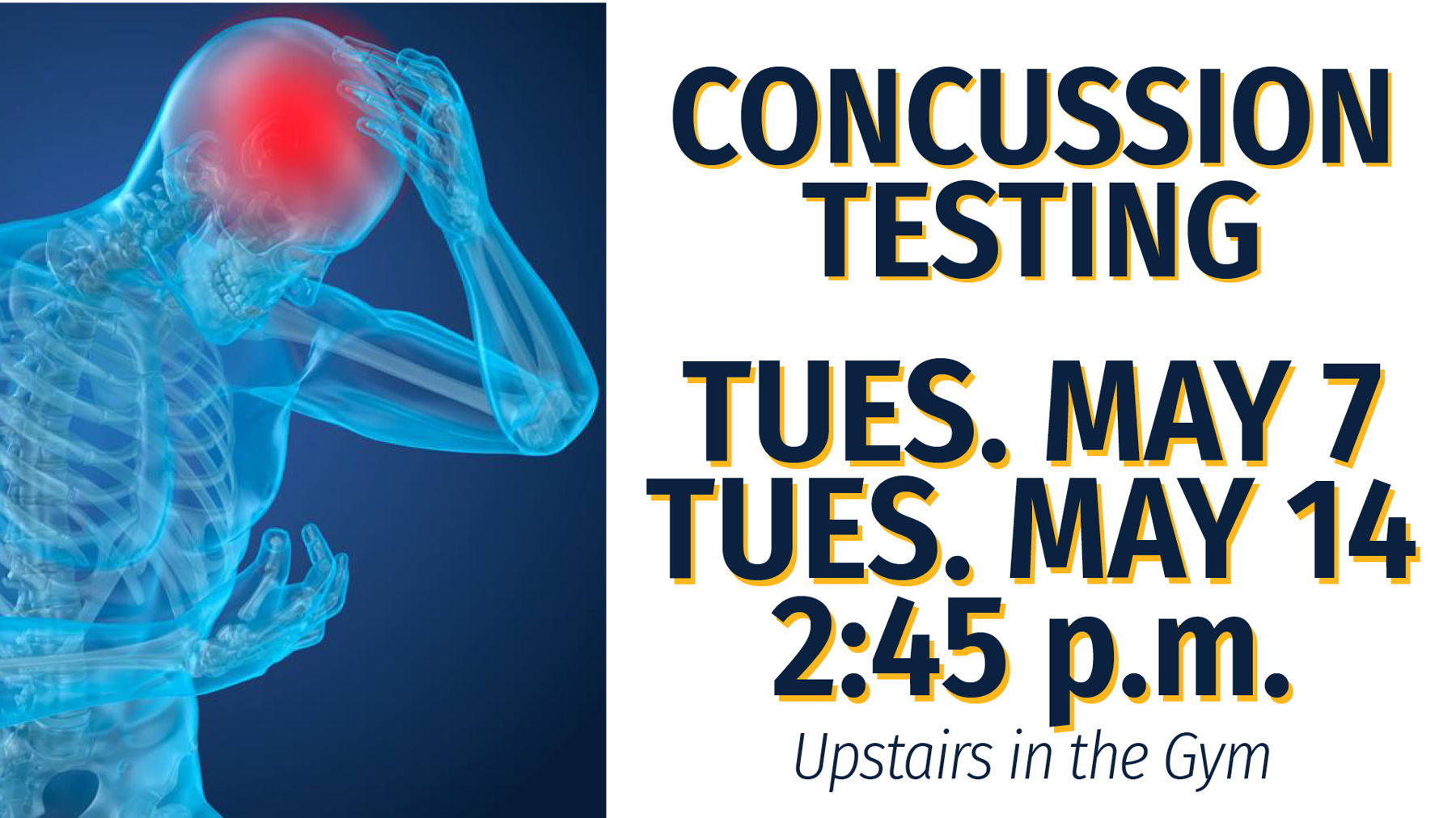Concussion Testing